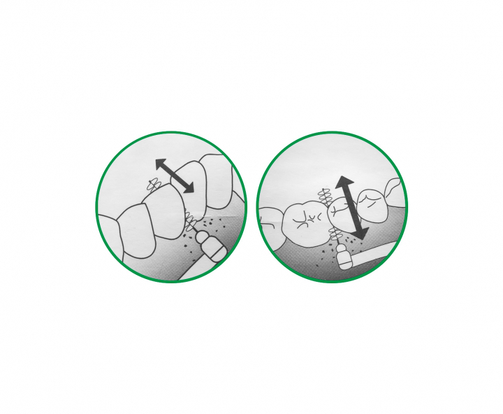 CEPITLLO DENTAL “L”